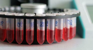 transcrição geral de análise de sangue