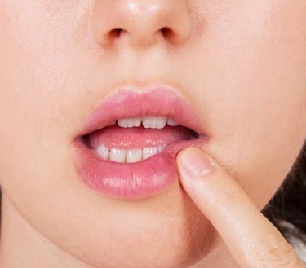 herpes na usnama simptoma