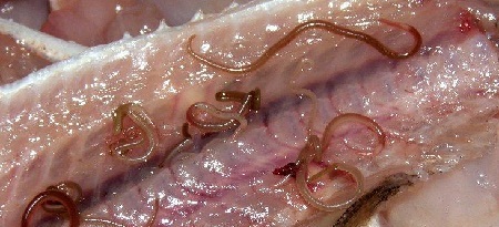 Worms - příznaky a léčba u dospělých