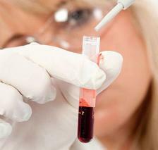 Augmentation de l'acide urique dans le sang