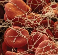 Vad är fibrinogen i blodet: normen och orsakerna till ökningen